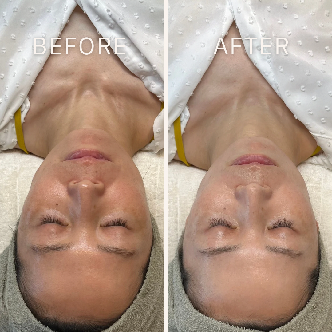 Black and White Minimalist Before After Beauty Instagram Postのコピー